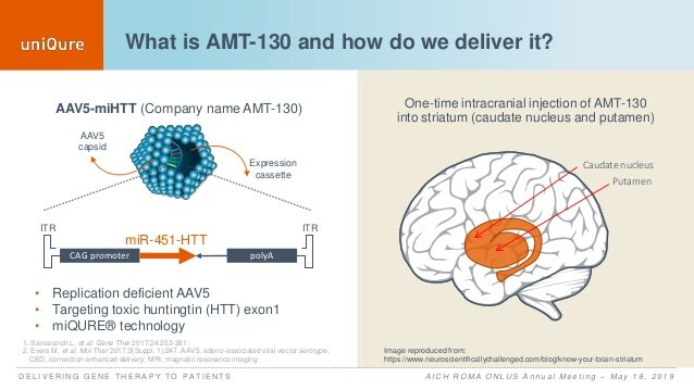 Wat is AMT-130? Gentherapie tegen Huntington’s ziekte uitgelegd
